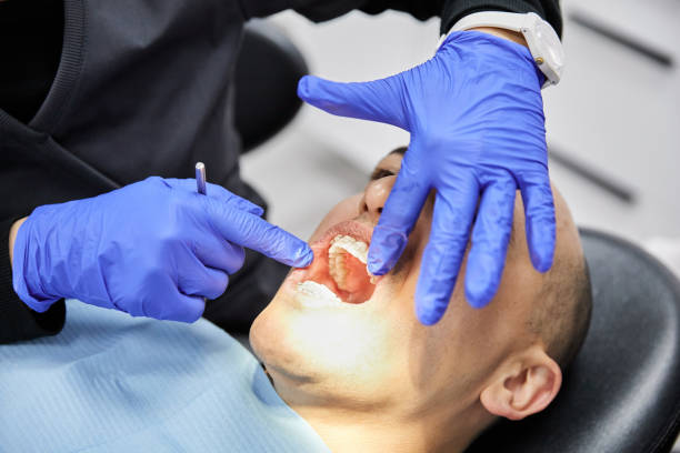 Best Broken or Chipped Tooth Repair in Midtown, TN