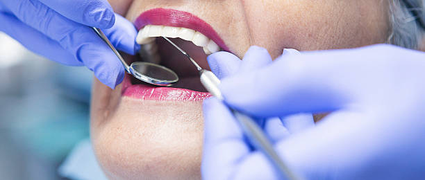 Best Emergency Wisdom Tooth Extraction in Midtown, TN